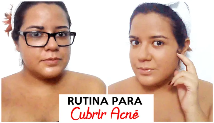 Cubrir2BAcn25C325A92Bcon2BMaquillaje
