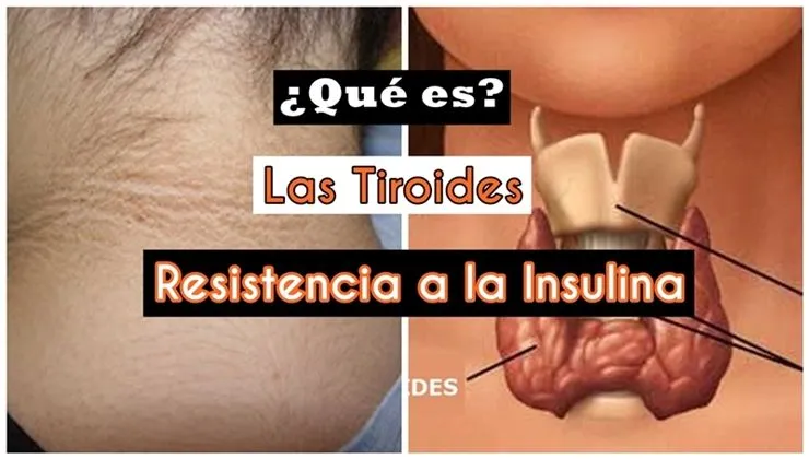 Insulina2By2BTiroides
