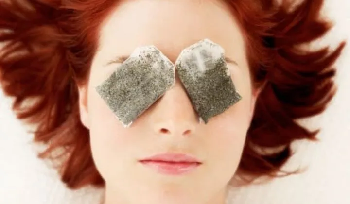 Tratamientos caseros para las ojeras