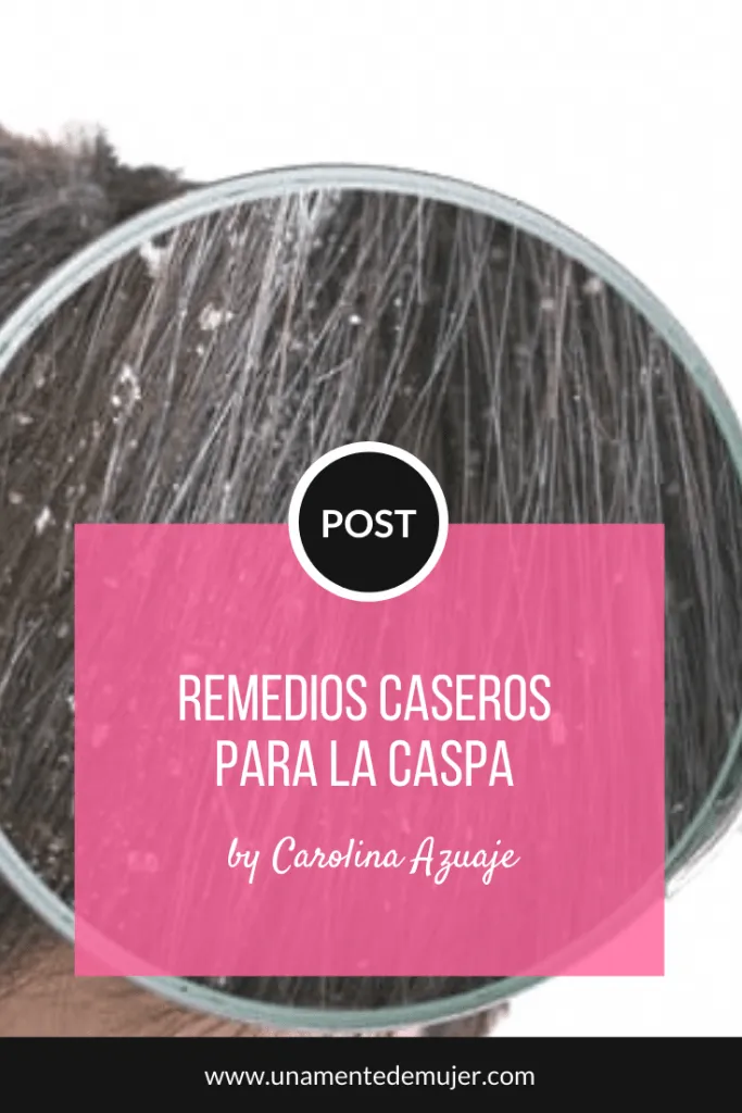 5 Remedios Caseros Para La Caspa