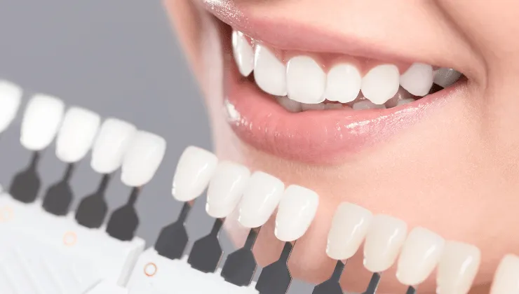 c&oacute;mo quitar el sarro en los dientes