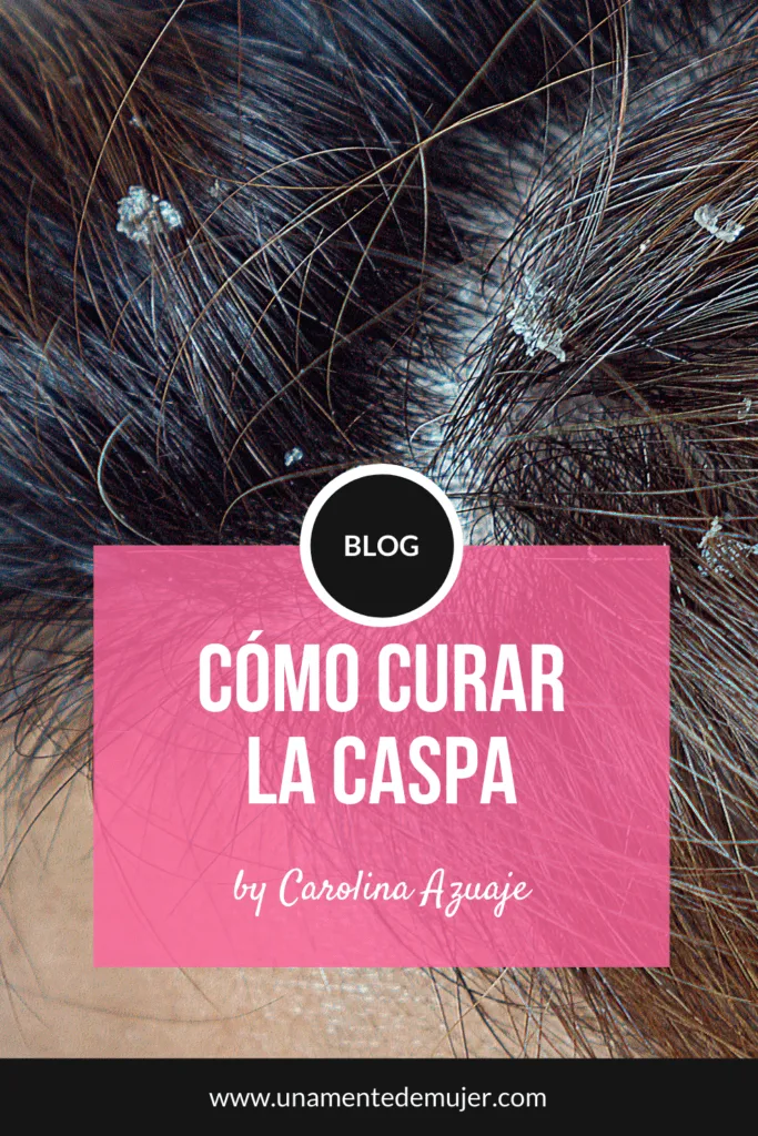 c&oacute;mo curar la caspa