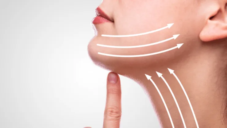 Lifting facial