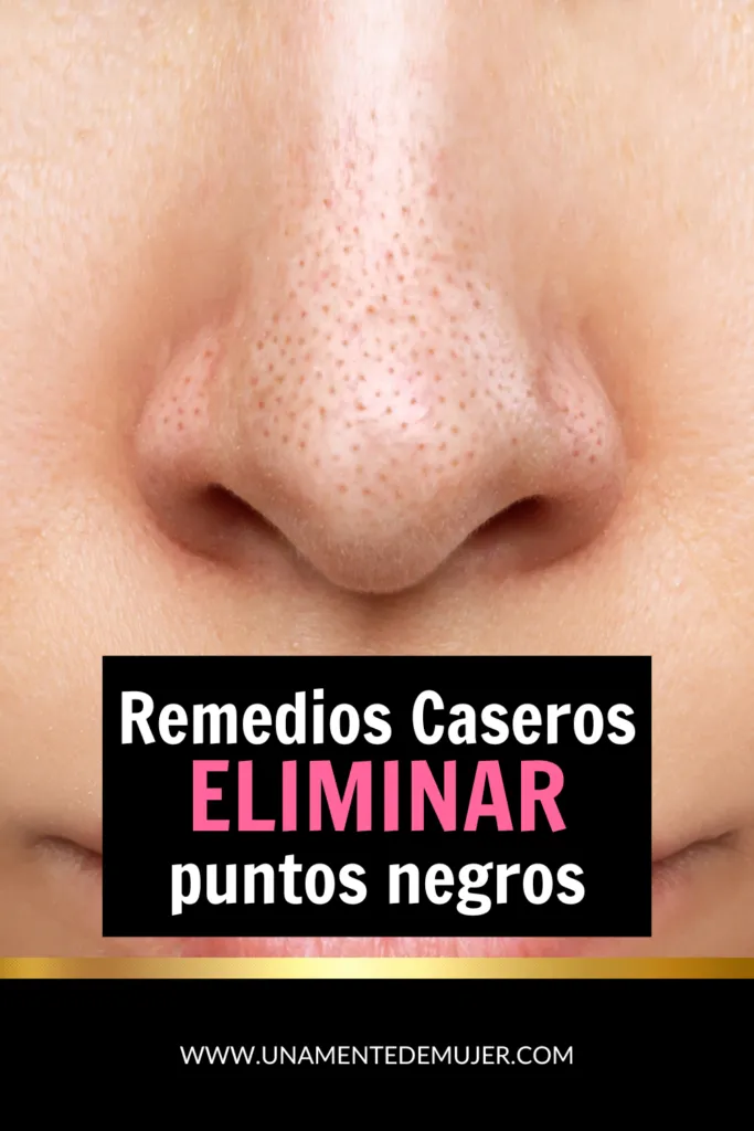 c&oacute;mo eliminar puntos negros de la cara